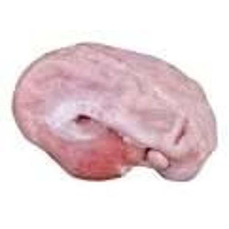 IBP FROZEN PORK STOMACHS